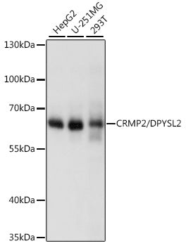 [KO Validated] CRMP2/DPYSL2 Rabbit pAb