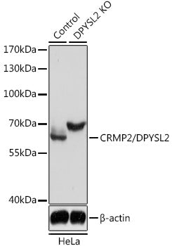 [KO Validated] CRMP2/DPYSL2 Rabbit pAb