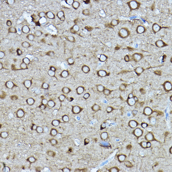 [KO Validated] CRMP2/DPYSL2 Rabbit pAb