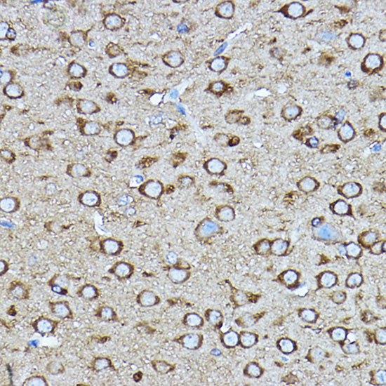 [KO Validated] CRMP2/DPYSL2 Rabbit pAb