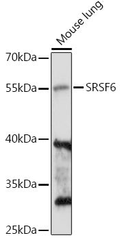SRSF6 Rabbit pAb