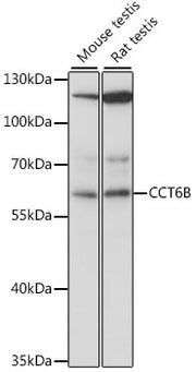 CCT6B Rabbit pAb