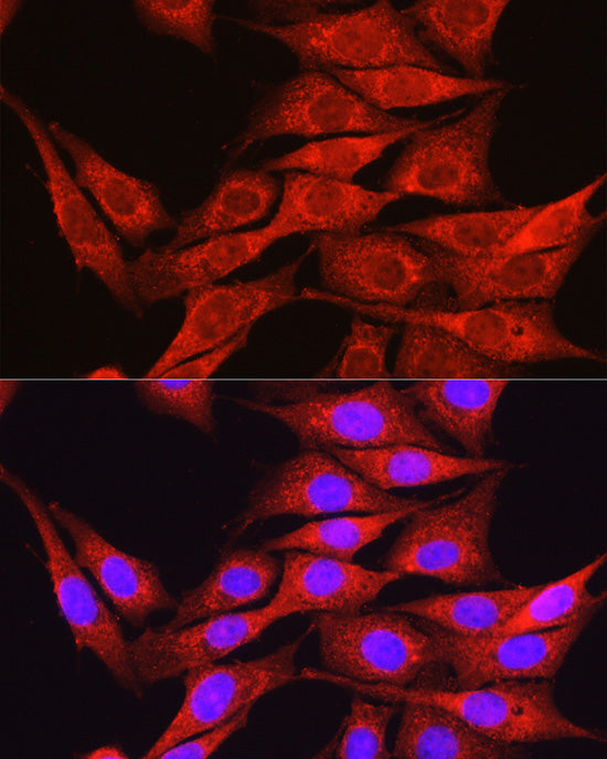 Osteocalcin (BGLAP) Rabbit pAb