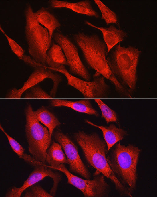 Osteocalcin (BGLAP) Rabbit pAb