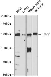 IPO8 Rabbit pAb