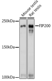 FIP200 Rabbit pAb