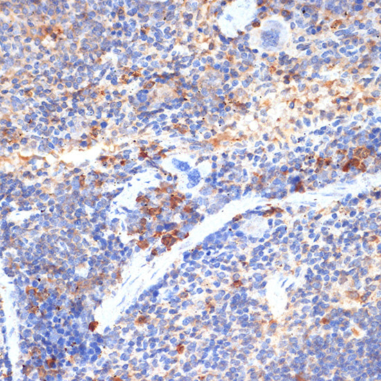 FIP200 Rabbit pAb