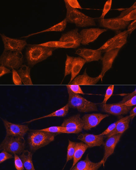 Apolipoprotein A2 Rabbit pAb