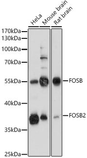 FOSB Rabbit pAb
