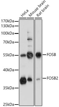 FOSB Rabbit pAb
