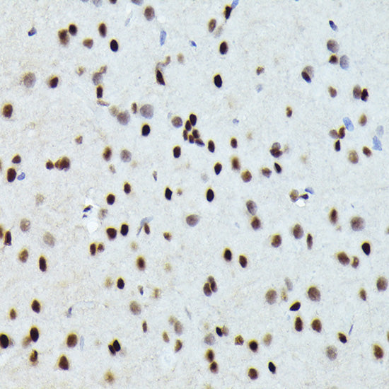 FOSB Rabbit pAb