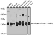 Casein Kinase 2 beta (CSNK2B) Rabbit pAb