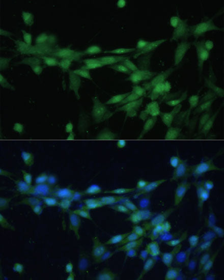 Casein Kinase 2 beta (CSNK2B) Rabbit pAb
