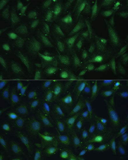 Casein Kinase 2 beta (CSNK2B) Rabbit pAb