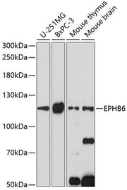 EPHB6 Rabbit pAb