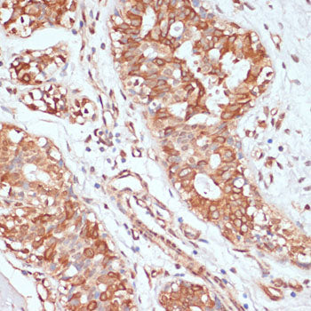 PTPRN2 Rabbit pAb
