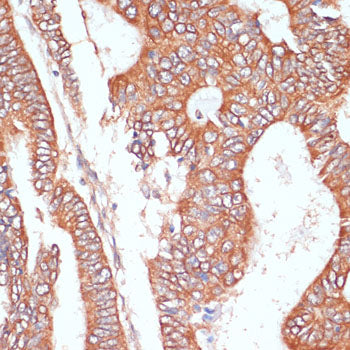 PTPRN2 Rabbit pAb