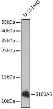 S100A5 Rabbit pAb