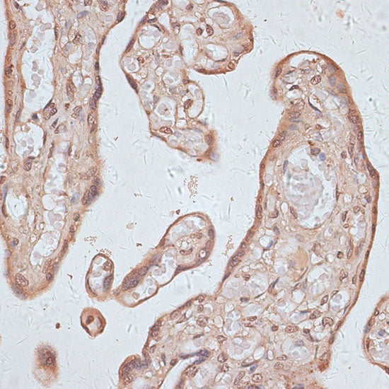 TLK1 Rabbit pAb