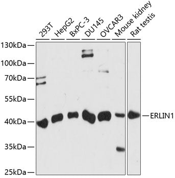 ERLIN1 Rabbit pAb