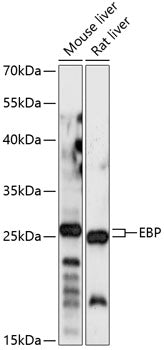 EBP Rabbit pAb