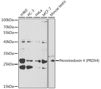 [KO Validated] Peroxiredoxin 4 (PRDX4) Rabbit pAb