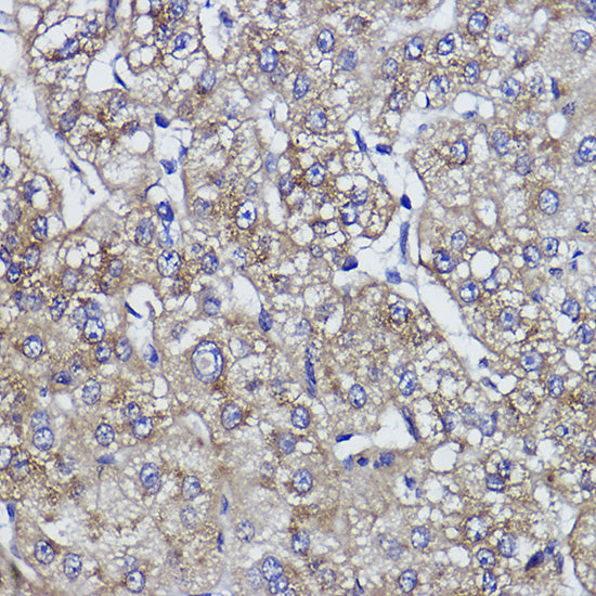 ZNF259 Rabbit mAb