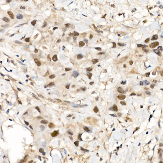 CDK12 Rabbit pAb