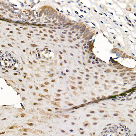 CDK12 Rabbit pAb