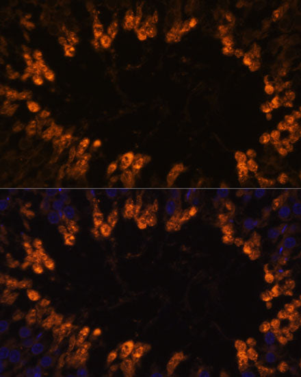 OXCT2 Rabbit pAb