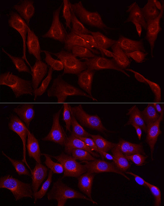 LDL Receptor (LDLR) Rabbit pAb