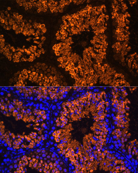 LDHC Rabbit pAb