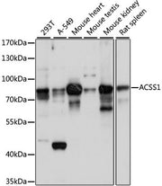 ACSS1 Rabbit pAb