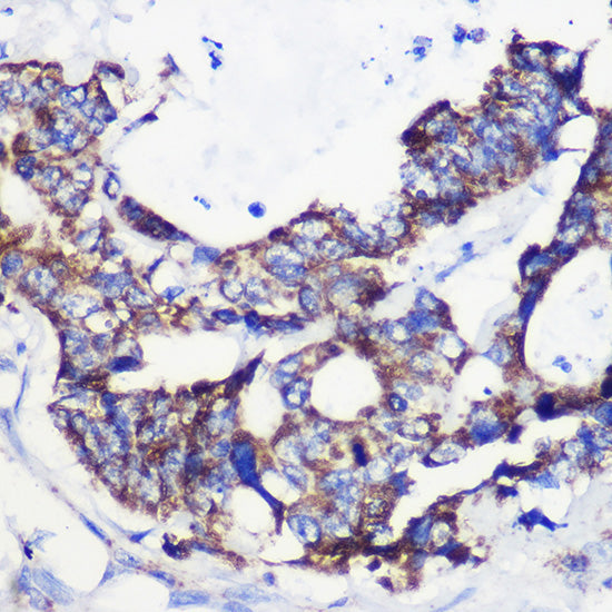 ACSS1 Rabbit pAb