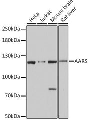 AARS Rabbit pAb