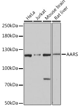 AARS Rabbit pAb