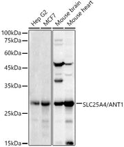 SLC25A4/ANT1 Rabbit pAb