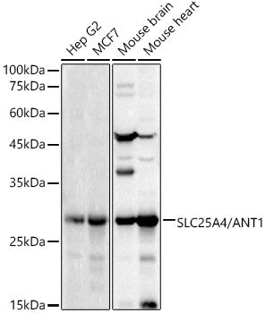 SLC25A4/ANT1 Rabbit pAb