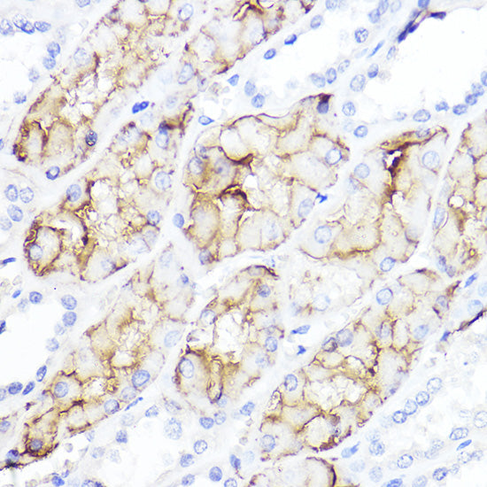 Aquaporin-1 (AQP1) Rabbit pAb