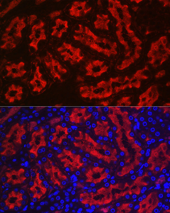 Aquaporin-1 (AQP1) Rabbit pAb