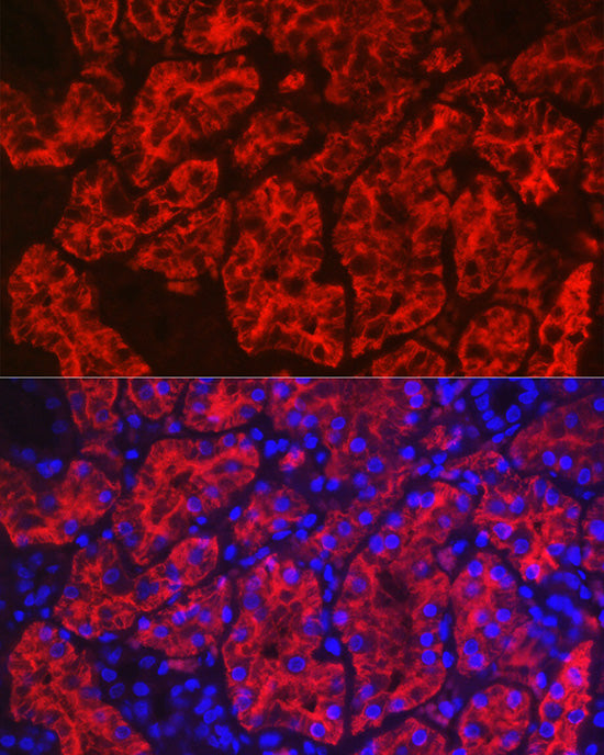 Aquaporin-1 (AQP1) Rabbit pAb