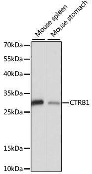 CTRB1 Rabbit pAb