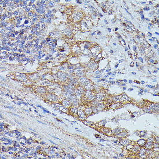 Cortactin Rabbit pAb