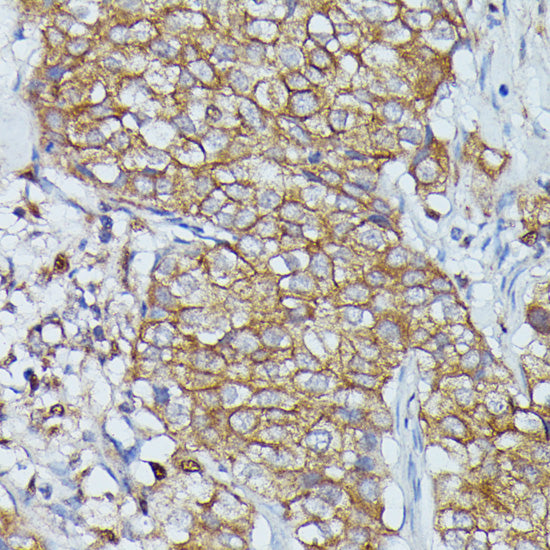 Cortactin Rabbit pAb