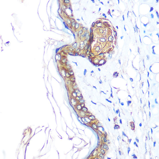 Cytokeratin 14 (KRT14) Rabbit pAb