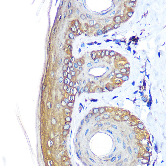 Cytokeratin 14 (KRT14) Rabbit pAb