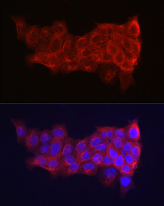 Cytokeratin 14 (KRT14) Rabbit pAb
