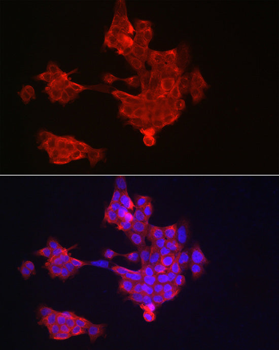 Cytokeratin 14 (KRT14) Rabbit pAb