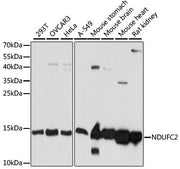 [KO Validated] NDUFC2 Rabbit pAb
