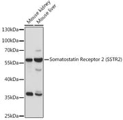 Somatostatin Receptor 2 (SSTR2) Rabbit pAb